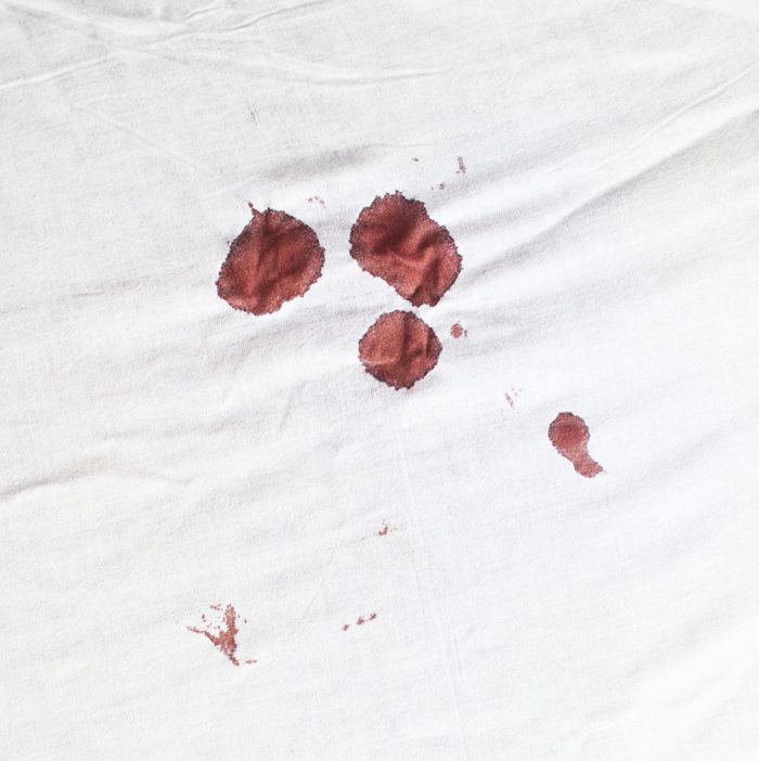 Bloodstains on a white sheet