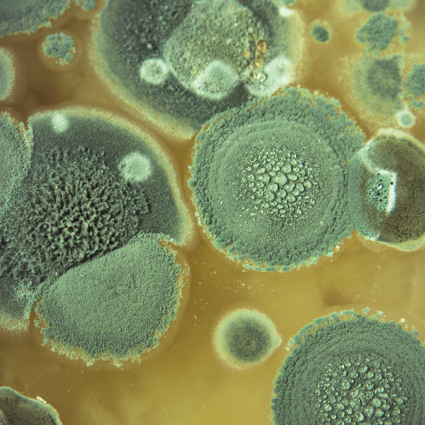 Aspergillus fumigatus