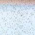 How to Remove Gnats from Your Home